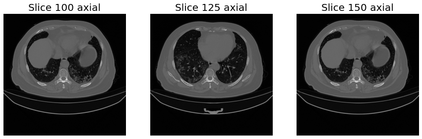 ../_images/examples_body_segmentation_4_0.png